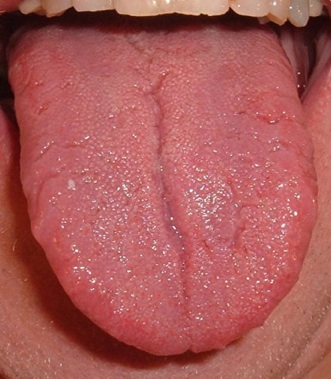 Tastebuds1