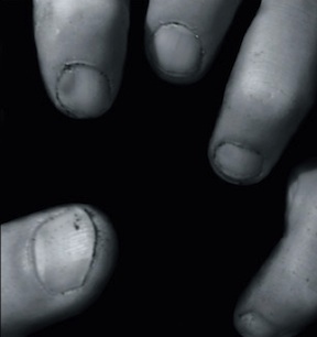 Fingernails