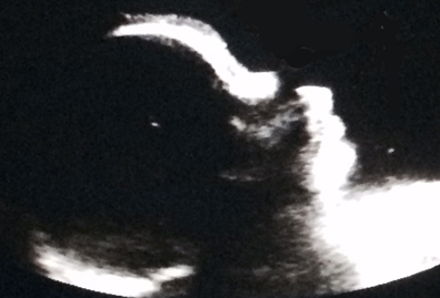 BabyHenry1