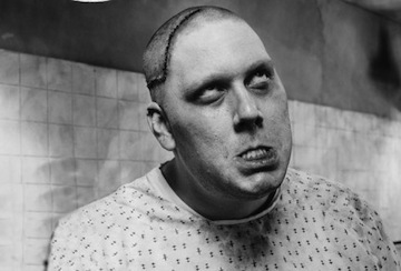 wholesaler-lobotomy